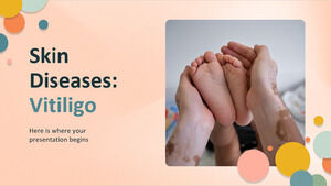 Boli de piele: Vitiligo