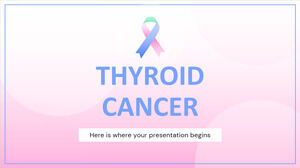 Kanker tiroid