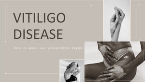 doença do vitiligo