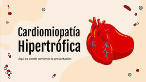Choroba kardiomiopatii przerostowej