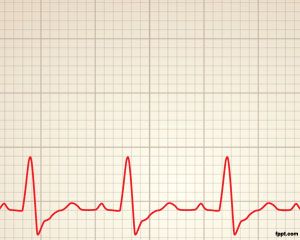 Kardiologie Rhythmus Power Point Vorlage