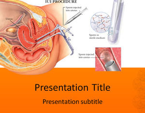 Visual surgery medical PPT template